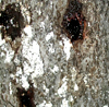Beech bark disease